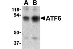 Western Blotting (WB) image for anti-Activating Transcription Factor 6 (ATF6) (N-Term) antibody (ABIN1031243) (ATF6 Antikörper  (N-Term))