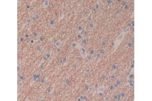 Immunohistochemistry (IHC) image for anti-Protein tyrosine Phosphatase, Non-Receptor Type 5 (Striatum-Enriched) (PTPN5) (AA 331-558) antibody (ABIN5014226)