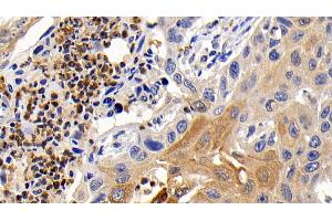 Immunohistochemistry (IHC) image for anti-BCL2-Like 1 (BCL2L1) (AA 2-212) antibody (ABIN7426781)