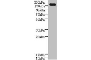Western blot All lanes: UBE2O antibody at 0. (UBE2O Antikörper  (AA 10-277))