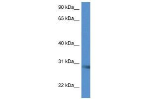 WB Suggested Anti-Scamp5 Antibody Titration: 1. (SCAMP5 Antikörper  (C-Term))