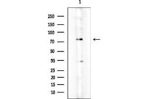 Western blot analysis of lysates from Mouse testis, using PKC gamma Mouse Monoclonal Antibody at 1/1000 dilution.