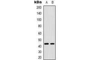 Western blot analysis of TBX1 expression in Jurkat (A), COLO205 (B) whole cell lysates. (T-Box 1 Antikörper  (C-Term))