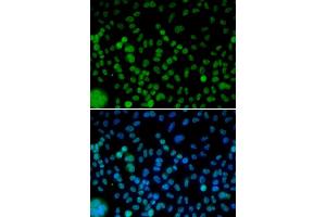Immunofluorescence (IF) image for anti-Interferon Regulatory Factor 2 (IRF2) antibody (ABIN1873262) (IRF2 Antikörper)