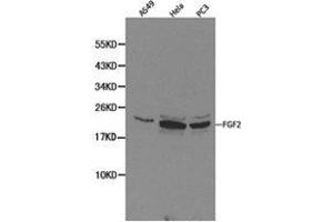 Western Blotting (WB) image for anti-Fibroblast Growth Factor 2 (Basic) (FGF2) antibody (ABIN1872685)