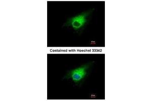 ICC/IF Image Immunofluorescence analysis of methanol-fixed A549, using PGD, antibody at 1:500 dilution. (PGD Antikörper)