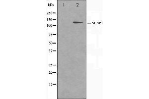 Western blot analysis on HuvEc cell lysate using SENP7 Antibody,The lane on the left is treated with the antigen-specific peptide.