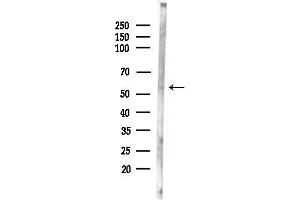 anti-STEAP Family Member 3, Metalloreductase (STEAP3) (N-Term) antibody