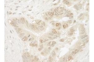 anti-Pygopus Homolog 1 (Drosophila) (PYGO1) (AA 300-350) antibody