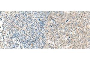 Immunohistochemistry of paraffin-embedded Human tonsil tissue using NPBWR1 Polyclonal Antibody at dilution of 1:50(x200) (NPBWR1 Antikörper)