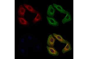 ABIN7093916 and ABIN7097960 staining Hela cells by IF/ICC. (MGAT1 Antikörper  (C-Term))