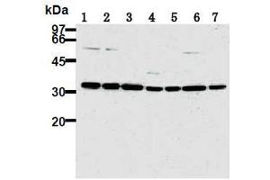 Western Blotting (WB) image for anti-Cyclin-Dependent Kinase 2 (CDK2) antibody (ABIN1106646) (CDK2 Antikörper)