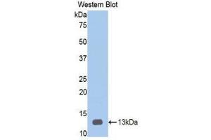 Western Blotting (WB) image for anti-Heparanase (HPSE) (AA 34-115) antibody (ABIN1859190) (HPSE Antikörper  (AA 34-115))