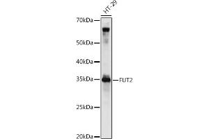 Western blot analysis of extracts of HT-29 cells, using FUT2 antibody (ABIN6129014, ABIN6140822, ABIN6140823 and ABIN6221384) at 1:1000 dilution. (FUT2 Antikörper  (AA 29-150))