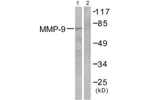 Western Blotting (WB) image for anti-Matrix Metallopeptidase 9 (Gelatinase B, 92kDa Gelatinase, 92kDa Type IV Collagenase) (MMP9) (C-Term) antibody (ABIN1848692) (MMP 9 Antikörper  (C-Term))