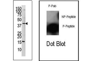 Image no. 2 for anti-Jun Proto-Oncogene (JUN) (pSer63) antibody (ABIN358110) (C-JUN Antikörper  (pSer63))