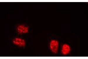 Immunofluorescent analysis of TCOF1 staining in HEK293T cells.