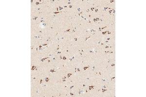 Immunohistochemistry (Paraffin-embedded Sections) (IHC (p)) image for anti-Solute Carrier Family 29 (Nucleoside Transporters), Member 1 (SLC29A1) (AA 402-431), (C-Term) antibody (ABIN387940)