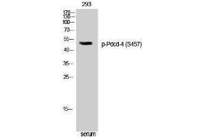 Western Blotting (WB) image for anti-Programmed Cell Death 4 (PDCD4) (pSer457) antibody (ABIN3182643) (PDCD4 Antikörper  (pSer457))