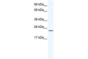 Western Blotting (WB) image for anti-Potassium Channel Tetramerisation Domain Containing 6 (KCTD6) antibody (ABIN2461578)