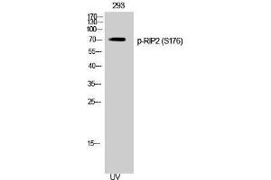 Western Blotting (WB) image for anti-ROP Interactive Partner 2 (RIP2) (pSer176) antibody (ABIN3182676) (RIP2 Antikörper  (pSer176))