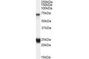 Western Blotting (WB) image for anti-Huntingtin Associated Protein 1 (HAP1) (Internal Region) antibody (ABIN2465804) (HAP1 Antikörper  (Internal Region))