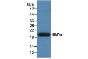 Detection of Recombinant TNC, Human using Polyclonal Antibody to Tenascin C (TNC) (TNC Antikörper  (AA 49-181))