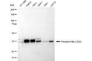 Western blotting analysis using Phospho-IKB alpha (S32) antibody (ABIN7799639).