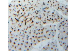 Used in DAB staining on fromalin fixed paraffin-embedded heart tissue (TNNI2 Antikörper  (AA 1-182))