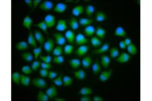 Immunofluorescence staining of Hela cells with ABIN7173520 at 1:166, counter-stained with DAPI. (C2orf60 Antikörper  (AA 1-152))