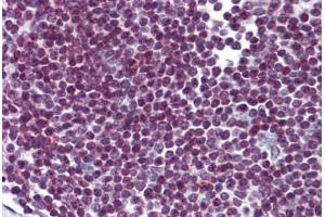 Human Spleen: Formalin-Fixed, Paraffin-Embedded (FFPE) (FOXO3 Antikörper  (AA 361-460))