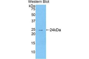 Western Blotting (WB) image for anti-Chemokine (C-C Motif) Ligand 25 (CCL25) (AA 24-150) antibody (ABIN1174416) (CCL25 Antikörper  (AA 24-150))