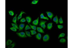 Immunofluorescence staining of A549 cells with ABIN7144528 at 1:166, counter-stained with DAPI. (ALOX12 Antikörper  (AA 508-658))