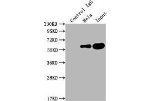 Immunoprecipitating PKM in Hela whole cell lysate Lane 1: Rabbit control IgG instead of ABIN7127769 in Hela whole cell lysate. (Rekombinanter PKM Antikörper)
