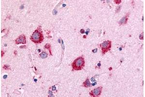Anti-NEK7 antibody  ABIN1049091 IHC staining of human brain, neurons and glia. (NEK7 Antikörper  (Kinase Domain))