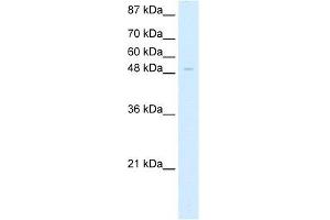 Human HepG2; WB Suggested Anti-ZNF70 Antibody Titration: 5. (ZNF70 Antikörper  (C-Term))