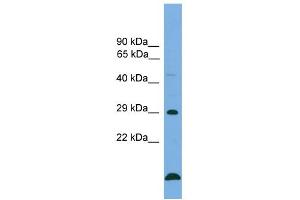 WB Suggested Anti-BCL2 Antibody Titration: 0. (Bcl-2 Antikörper  (Middle Region))