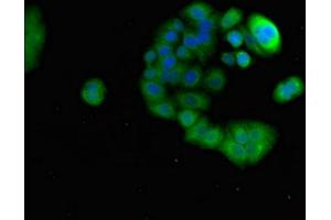 Immunofluorescent analysis of PC-3 cells using ABIN7164763 at dilution of 1:100 and Alexa Fluor 488-congugated AffiniPure Goat Anti-Rabbit IgG(H+L) (PRR11 Antikörper  (AA 1-360))