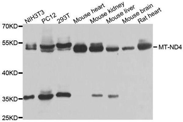 Mitochondrially Encoded NADH Dehydrogenase 4 (MT-ND4) (AA 350-450) antibody