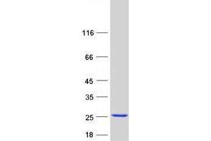 Western Blotting (WB) image for Ubiquitin-Conjugating Enzyme E2D 3 (UBE2D3) (Transcript Variant 9) protein (Myc-DYKDDDDK Tag) (ABIN2734802)