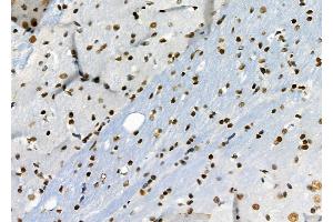ABIN6264661 and ABIN6276692 at 1/100 staining Rat brain tissue by IHC-P. (Retinoblastoma Binding Protein 4 Antikörper  (C-Term))