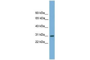 WB Suggested Anti-HLA-DQA2 Antibody Titration:  0. (HLA-DQA2 Antikörper  (Middle Region))