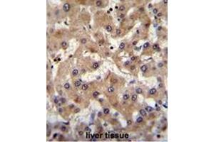 PRAMEF6 Antibody (C-term) immunohistochemistry analysis in formalin fixed and paraffin embedded human liver tissue followed by peroxidase conjugation of the secondary antibody and DAB staining. (PRAMEF6 Antikörper  (C-Term))