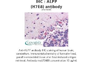 Image no. 1 for anti-Placental Alkaline Phosphatase (ALPP) antibody (ABIN1723355) (PLAP Antikörper)