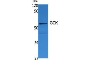 Western Blot (WB) analysis of specific cells using GCK Polyclonal Antibody. (GCK Antikörper  (N-Term))