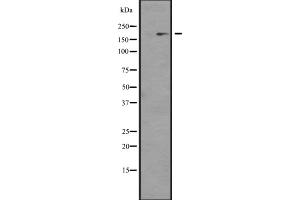 Western blot analysis of NCOA1 expression in KAT13A / SRC1 transfected 293 cell line lysate;,The lane on the left is treated with the antigen-specific peptide. (NCOA1 Antikörper)