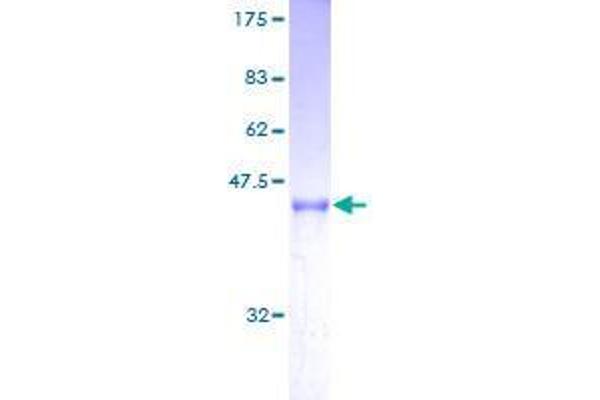 ARL2BP Protein (AA 1-163) (GST tag)