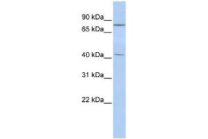 WB Suggested Anti-KLHL3 Antibody Titration:  0. (KLHL3 Antikörper  (Middle Region))