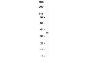 Western blot testing of Glucocorticoid receptor antibody and recombinant human protein (0.