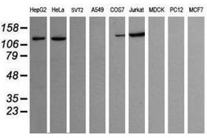 Image no. 2 for anti-Phosphoinositide-3-Kinase, Catalytic, gamma Polypeptide (PIK3CG) antibody (ABIN1500208) (PIK3 gamma Antikörper)